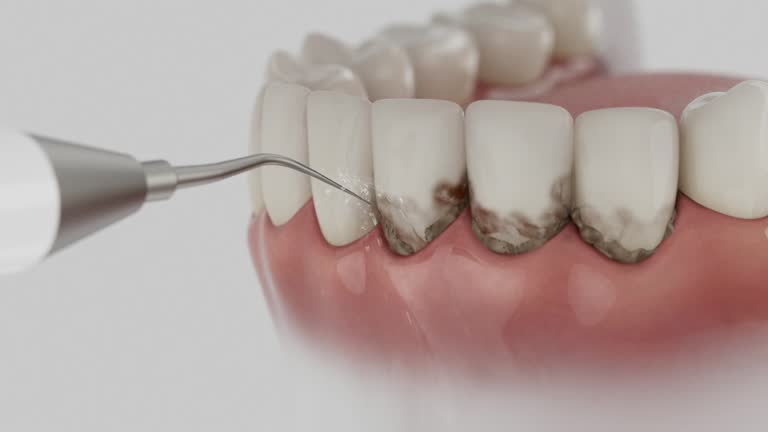 Trusted Teeth Cleaning And Checkup service in Fort Dix, NJ - Dentist Open Now